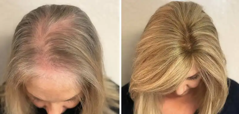 Before and after &mdash; Paula D.