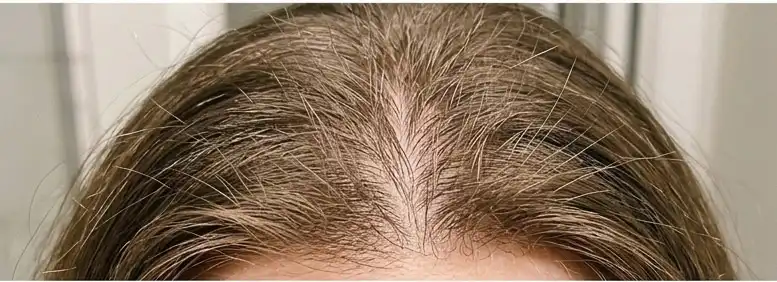 Weeks 3-4 progress